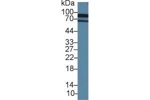 Western Blot; Sample: Porcine Cerebrum lysate; Primary Ab: 1. (Cadherin 13 anticorps  (AA 179-366))