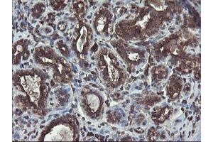 Immunohistochemical staining of paraffin-embedded Human breast tissue using anti-ACBD3 mouse monoclonal antibody. (ACBD3 anticorps)