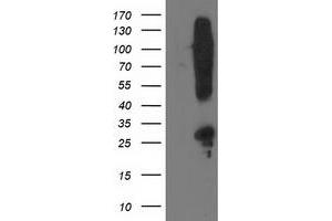 Western Blotting (WB) image for anti-Synaptosomal-Associated Protein, 25kDa (SNAP25) antibody (ABIN1501019)