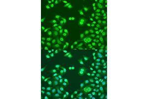 Immunofluorescence analysis of U2OS cells using NUM antibody (ABIN1681136, ABIN3015188, ABIN3015190 and ABIN6213875) at dilution of 1:100.