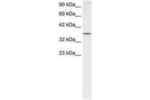 Image no. 1 for anti-Homeobox A7 (HOXA7) (N-Term) antibody (ABIN6735815) (HOXA7 anticorps  (N-Term))