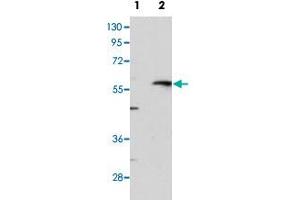 Western blot analysis of MMP13 (arrow) using MMP13 polyclonal antibody . (MMP13 anticorps  (C-Term))