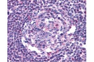 Image no. 1 for anti-Chemokine (C-C Motif) Receptor 5 (CCR5) (AA 6-20) antibody (ABIN208230)