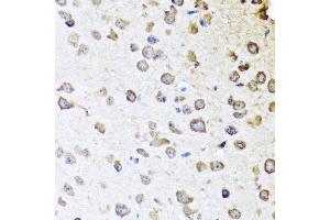 Immunohistochemistry of paraffin-embedded mouse brain using SERPINA10 antibody at dilution of 1:100 (40x lens). (SERPINA10 anticorps)