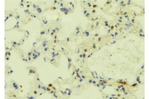 ABIN6273849 at 1/100 staining Mouse lung tissue by IHC-P. (FPR2 anticorps  (C-Term))