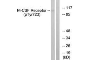 Western blot analysis of extracts from HuvEc cells treated with PMA 125ng/ml 30', using M-CSF Receptor (Phospho-Tyr723) Antibody.