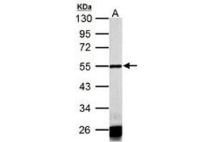 Image no. 2 for anti-Calsequestrin 1 (CASQ1) (AA 136-381) antibody (ABIN1501918) (Calsequestrin anticorps  (AA 136-381))