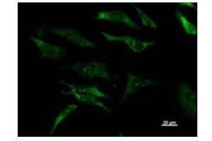 Immunostaining analysis in HeLa cells. (DHX29 anticorps)