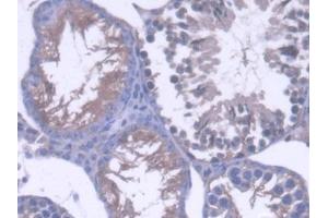IHC-P analysis of Mouse Testis Tissue, with DAB staining. (OS9 anticorps  (AA 471-672))