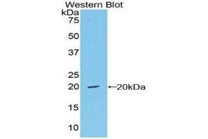 Western Blotting (WB) image for anti-Von Willebrand Factor (VWF) (AA 1498-1665) antibody (Biotin) (ABIN1173732) (VWF anticorps  (AA 1498-1665) (Biotin))