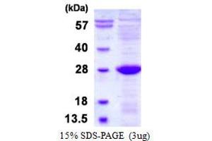 Image no. 1 for UL16 Binding Protein 2 (ULBP2) protein (His tag) (ABIN1098658) (ULBP2 Protein (His tag))