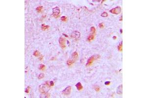 Immunohistochemical analysis of JIP2 staining in human brain formalin fixed paraffin embedded tissue section.