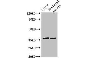 Western Blot Positive WB detected in: Mouse liver tissue, Mouse skeletal muscle tissue All lanes: LYVE1 antibody at 3 μg/mL Secondary Goat polyclonal to rabbit IgG at 1/50000 dilution Predicted band size: 36 kDa Observed band size: 36 kDa (LYVE1 anticorps  (AA 20-238))
