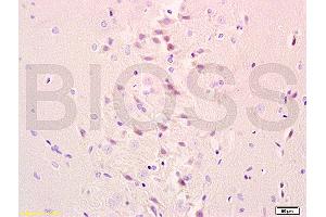 anti-Galactosylceramidase (GALC) (AA 301-400) antibody