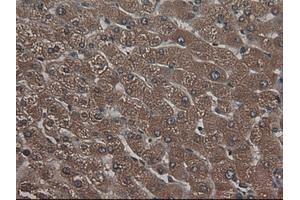 Image no. 1 for anti-Carboxypeptidase A1 (Pancreatic) (CPA1) (AA 1-419) antibody (ABIN1490772) (CPA1 anticorps  (AA 1-419))