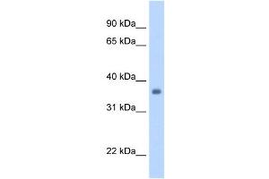 SGCG antibody used at 1. (SGCG anticorps)