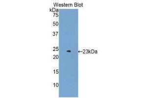 Western Blotting (WB) image for anti-Erythropoietin Receptor (EPOR) (AA 45-244) antibody (ABIN1172012) (EPOR anticorps  (AA 45-244))