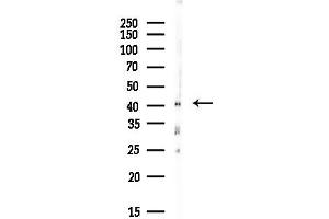 anti-Protein Arginine Methyltransferase 1 (PRMT1) (C-Term) antibody