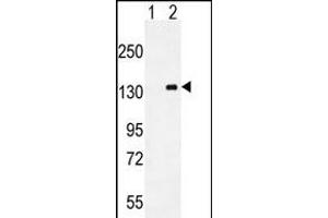 Western blot analysis of CSF1R (arrow) using mouse Monoclonal CSF1R ABIN659076. (CSF1R anticorps)