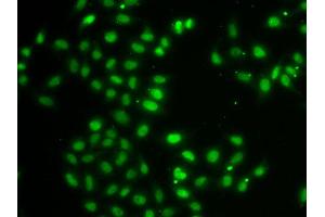Immunofluorescence analysis of MCF7 cell using DUSP22 antibody. (DUSP22 anticorps)