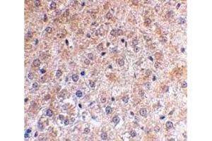 Immunohistochemistry (IHC) image for anti-Tumor Protein P53 Inducible Nuclear Protein 1 (TP53INP1) (N-Term) antibody (ABIN1031500) (TP53INP1 anticorps  (N-Term))
