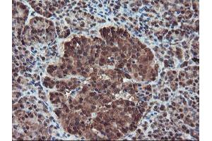 Image no. 1 for anti-serpin Peptidase Inhibitor, Clade B (Ovalbumin), Member 1 (SERPINB1) (AA 77-306) antibody (ABIN1491671)