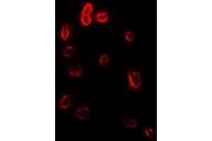 Immunofluorescent analysis of Stomatin staining in Hela cells. (Stomatin anticorps)