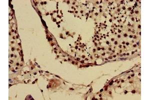 Immunohistochemistry of paraffin-embedded human testis tissue using ABIN7153811 at dilution of 1:100 (USO1 anticorps  (AA 591-733))