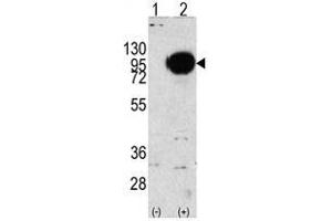 Image no. 1 for anti-Phosphorylase, Glycogen, Muscle (PYGM) (C-Term) antibody (ABIN356948) (PYGM anticorps  (C-Term))