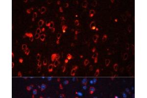 Immunofluorescence analysis of Mouse brain using KCNA1 Polyclonal Antibody at dilution of 1:100. (KCNA1 anticorps)