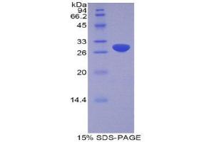 SDS-PAGE (SDS) image for ADAM Metallopeptidase Domain 20 (ADAM20) (AA 367-615) protein (His tag) (ABIN1877790)