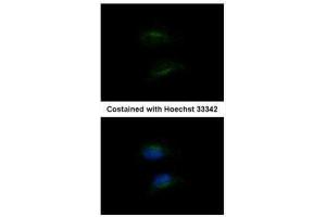 ICC/IF Image Immunofluorescence analysis of methanol-fixed HeLa, using HSD3B2, antibody at 1:200 dilution.