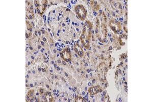 Immunohistochemistry of paraffin-embedded rat kidney using EPXH2 antibody at dilution of 1:200 (x400 lens). (EPHX2 anticorps)