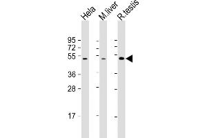 All lanes : Anti-CHRNB2 Antibody (N-Term) at 1:2000 dilution Lane 1: Hela whole cell lysate Lane 2: mouse liver lysate Lane 3: rat testis lysate Lysates/proteins at 20 μg per lane. (CHRNB2 anticorps  (AA 66-100))