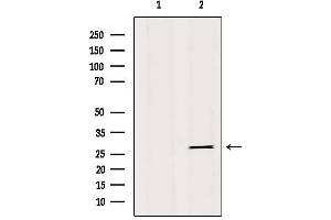 Western blot analysis of extracts from 293, using IBP4 Antibody. (IGFBP4 anticorps  (Internal Region))