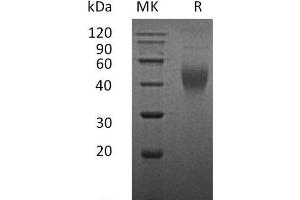 Western Blotting (WB) image for Colony Stimulating Factor 1 (Macrophage) (CSF1) (Active) protein (ABIN7320618) (M-CSF/CSF1 Protéine)