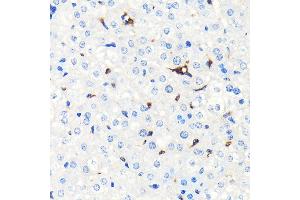 Immunohistochemistry of paraffin-embedded mouse liver using Heme Oxygenase 1 (HO-1/HMOX1) (HO-1/HMOX1) Rabbit mAb  at dilution of 1:100 (40x lens).
