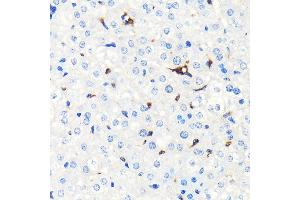 Immunohistochemistry of paraffin-embedded mouse liver using Heme Oxygenase 1 (HO-1/HMOX1) (HO-1/HMOX1) Rabbit mAb  at dilution of 1:100 (40x lens). (HMOX1 anticorps)