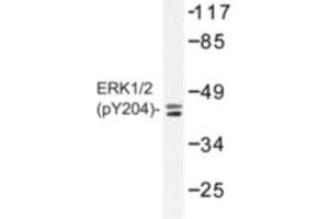 Image no. 1 for anti-Mitogen-Activated Protein Kinase 1/3 (MAPK1/3) (pThr187), (pTyr204) antibody (ABIN318321) (ERK1/2 anticorps  (pThr187, pTyr204))
