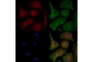 ABIN7094428 and ABIN7098476 staining  cells by IF/ICC. (GJB6 anticorps  (C-Term))