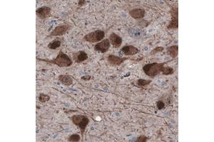 Immunohistochemical staining (Formalin-fixed paraffin-embedded sections) of human substantia nigra with DDC monoclonal antibody, clone CL2962  shows strong immunoreactivity in dopamine neurons.