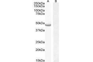 (ABIN570849) (0. (CETP anticorps  (N-Term))
