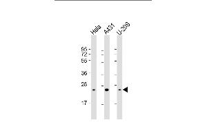 All lanes : Anti-RAB1B Antibody at 1:4000 dilution Lane 1: Hela whole cell lysate Lane 2: A431 whole cell lysate Lane 3: U-20S whole cell lysate Lysates/proteins at 20 μg per lane. (RAB1B anticorps  (AA 1-201))