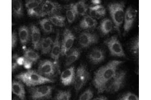 Immunofluorescent staining of A549 (ATCC CCL-185) cells. (Calretinin anticorps  (AA 38-151))