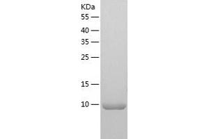 Western Blotting (WB) image for WW Domain Binding Protein 1 (WBP1) (AA 170-269) protein (His-IF2DI Tag) (ABIN7125745)