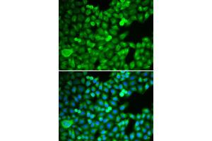 Immunofluorescence analysis of MCF-7 cell using PSMB5 antibody. (PSMB5 anticorps  (AA 1-263))