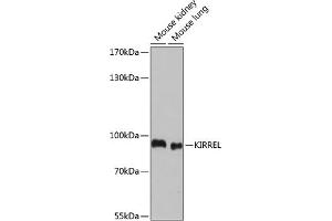 Western blot analysis of extracts of various cell lines, using KIRREL antibody (ABIN7268117) at 1:1000 dilution. (KIRREL anticorps  (AA 17-200))