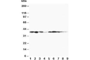 Western blot testing of MEK3 antibody and Lane 1:  rat spleen;  2: rat thymus;  3: rat skeletal muscle;  4: rat kidney, and human samples  5: MCF-7;  6: HeLa;  7: Raji;  8: CEM;  9: COLO320 cell lysate (MAP2K3 anticorps  (C-Term))