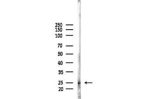 anti-TGFB-Induced Factor Homeobox 2-Like, X-Linked (TGIF2LX) (Internal Region) antibody
