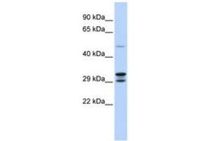 Image no. 1 for anti-Chromosome 14 Open Reading Frame 166 (C14orf166) (N-Term) antibody (ABIN6742833) (C14orf166 anticorps  (N-Term))